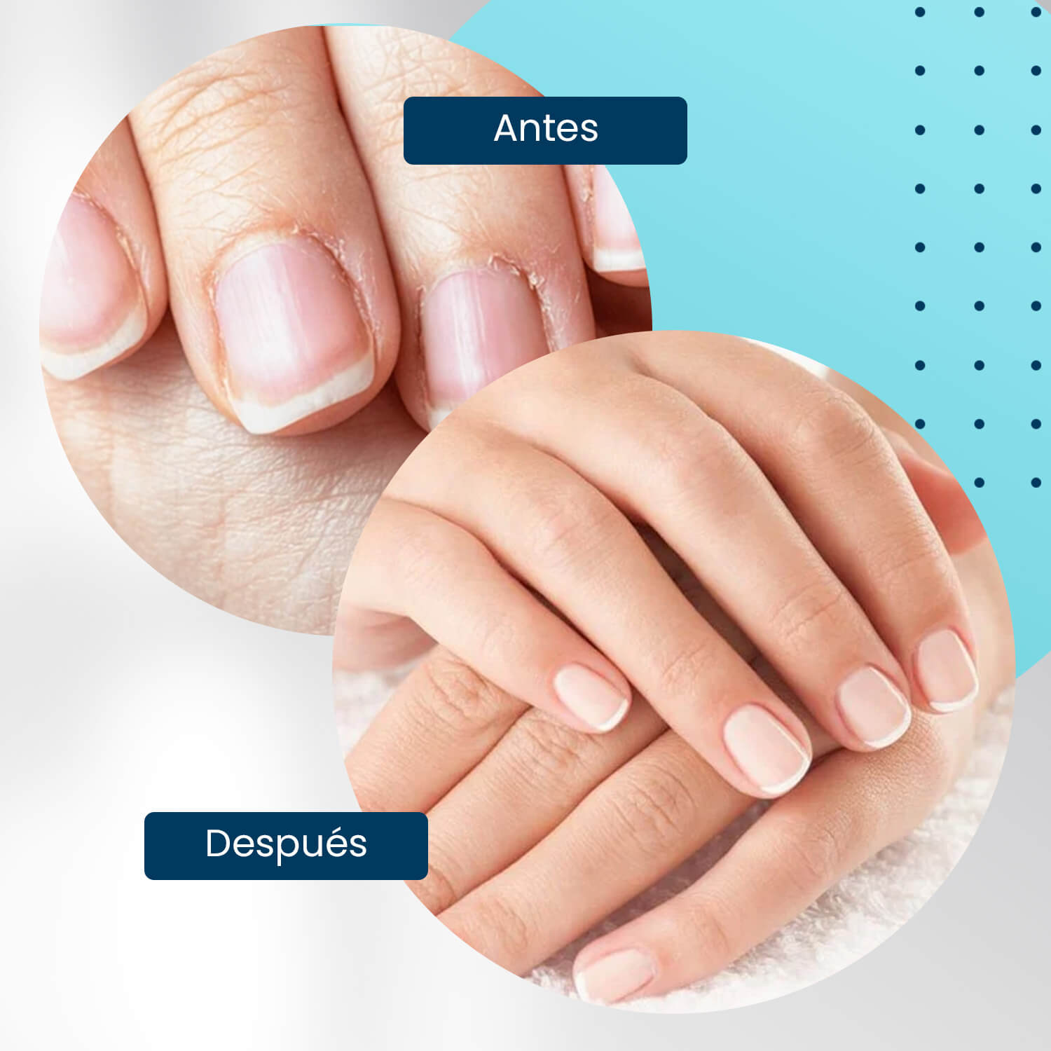 Cuticle Oil Strawberry Roll On 10ml - Aceite para cutículas Aroma Fresa - Nooves Nails-4