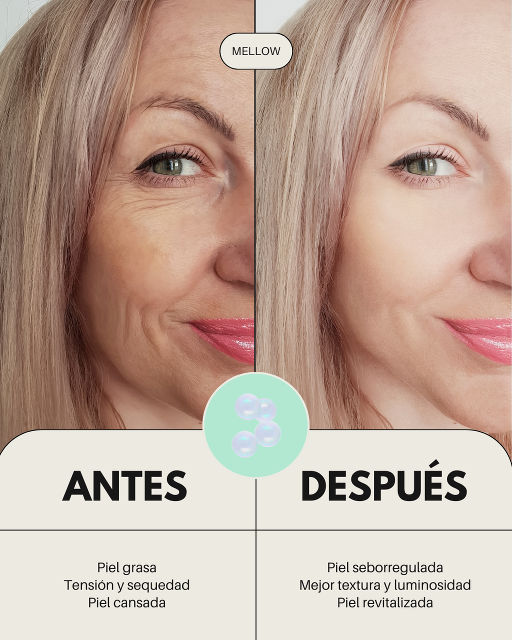 Pack Rutina Facial ECO - PIEL ACNEICA