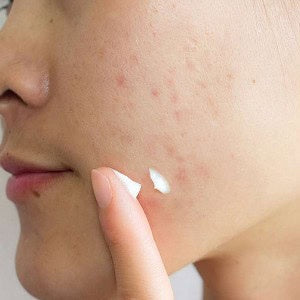 Skin1004 Madagascar Centella Tea-Trica Spot Cream – 20 ml